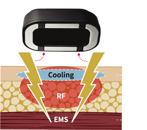 RF/EMS 雙電探頭運作過程